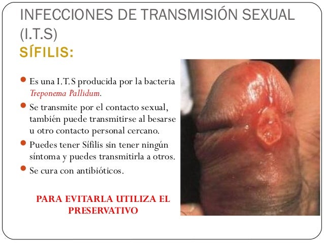 SHEMALE YOU TUBE Do Porn Sites Have Viruses